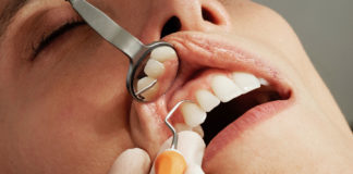 Things-You-Must-Avoid-Getting-Decayed-Teeth-on-americastrend
