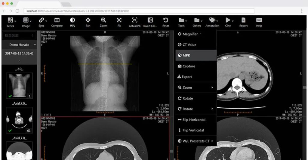 DICOM reader online