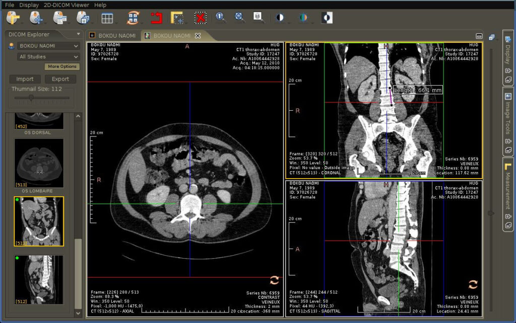 free DICOM viewer