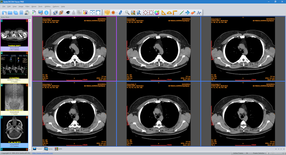 free DICOM viewer